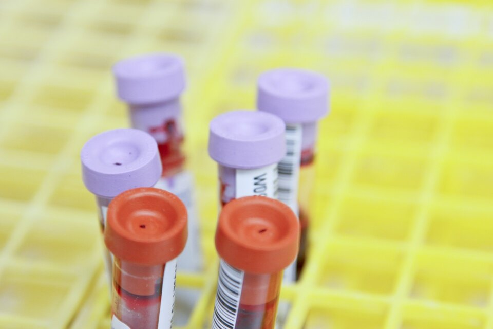 Krebs-Scan“-Police: Verbraucherschutz und Risiken im Fokus | © National Cancer Institute / Unsplash Auf dem Bild sieht man sechs Laborröhren. Zwei davon haben einen orangefarbenen Deckel, vier haben einen hellviolett farbenen Deckel. | © National Cancer Institute / Unsplash
